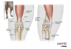 Patella Luxation in Dogs. Image by PetMD by Chewy