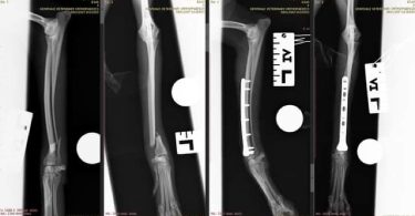 Leg fracture in an Italian Greyhound shown before and after plating